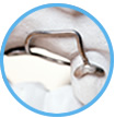  Orthodontische hulpmiddelen