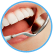 Symptomen, oorzaken en behandeling van tandvleesontsteking